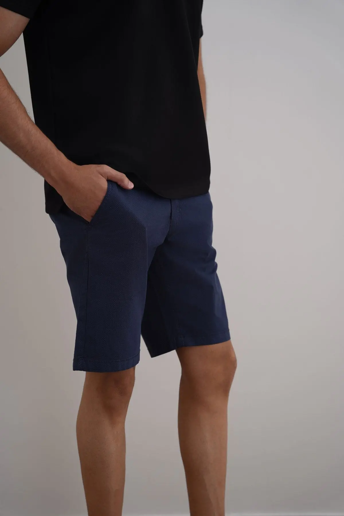Printed Chino Shorts 1